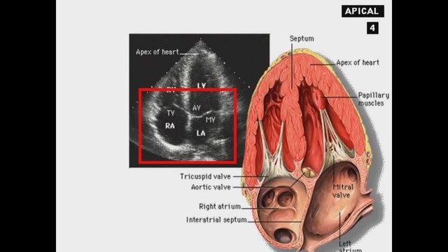 Echocardiography