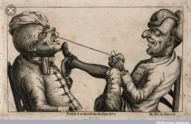 Dentistry in the 17th Century