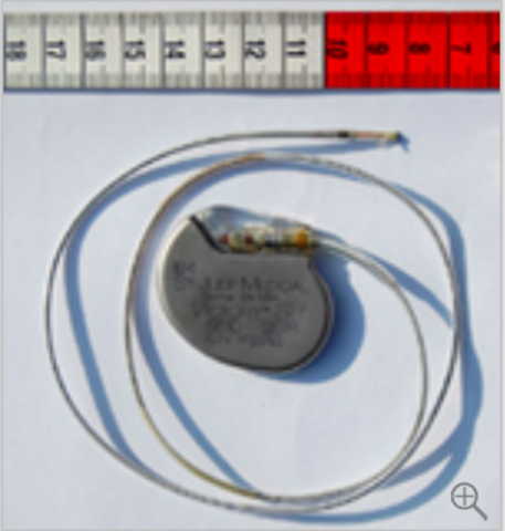 John Hopps invents the first cardiac pacemaker