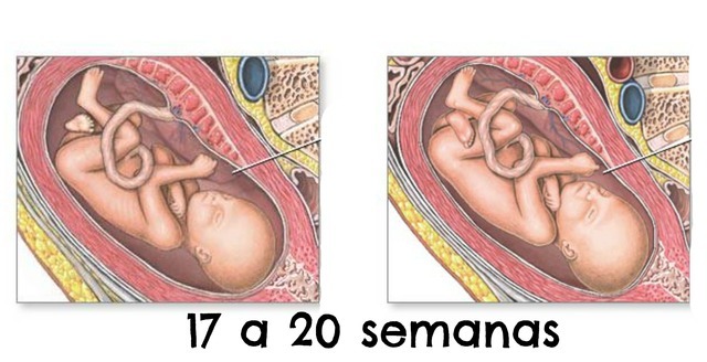 semana 17- 20