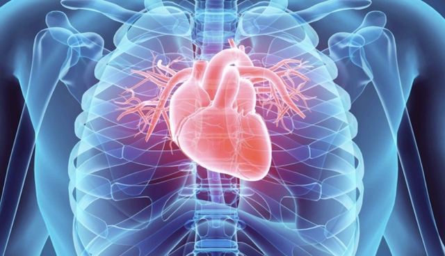 Cardiovascular disease