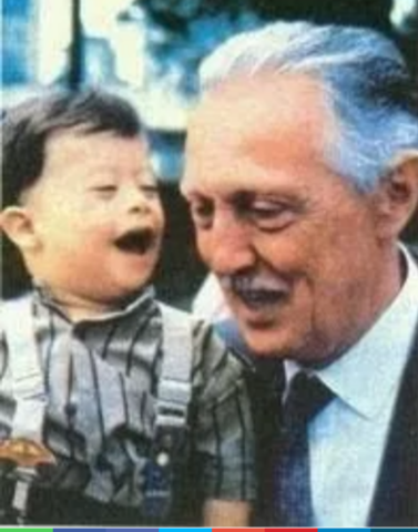 Años Atras De Síndrome Del Down