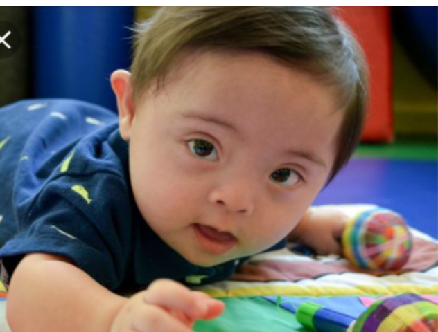 Cuidados De Síndrome De Down