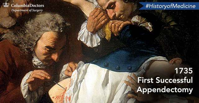 Claudius Aymand performs the first successful appendectomy