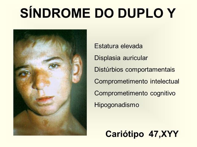 Síndrome del doble Y, XYY