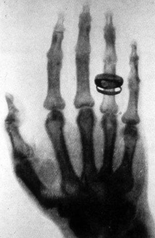 X-Ray