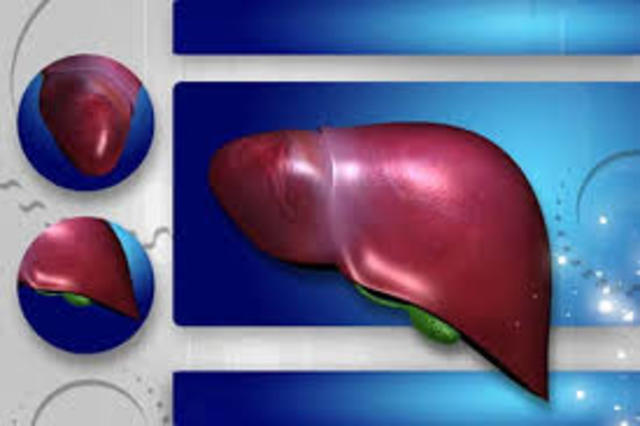 Artificial liver and kidney