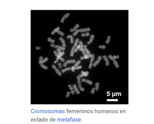 ALTERACIÓN CROMOSOMICA