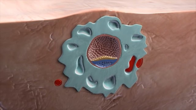 Finalización de implantación del blastocito