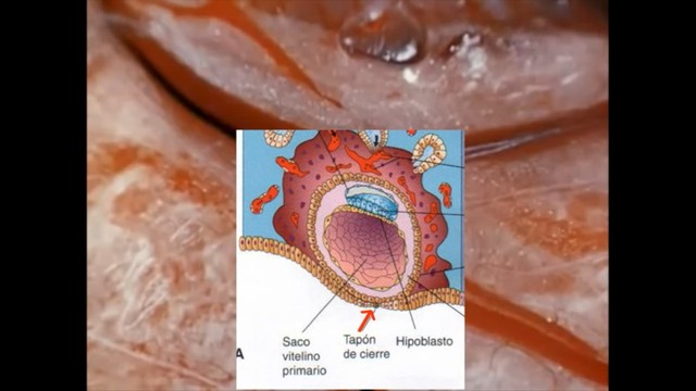 Se crea un tapón de cierre