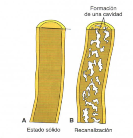 Se oblitera la luz del duodeno