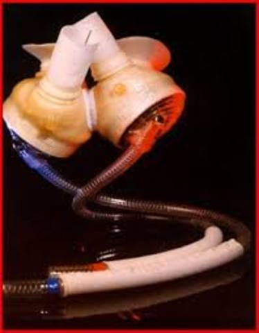 The first FDA approved implanted Abiocor artificial heart placed in a patient died on August 23