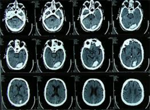 Inician nuevas técnicas de imagen cerebral