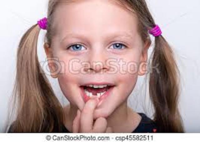 Lost my first tooth