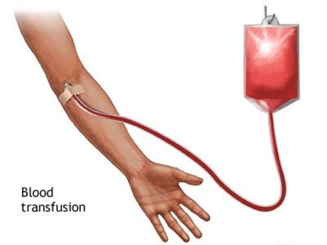 human blood transfusion (industrial revolution)
