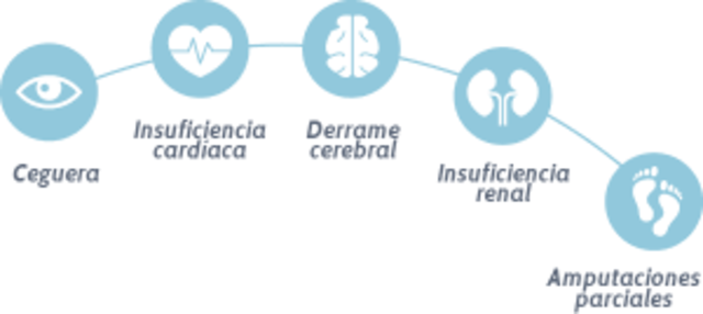 Se reducen las complicaciones de la diabetes. Un estudio informó sobre una enorme mejoría en la incidencia de complicaciones de la diabetes como resultado de los avances en la investigación y los tratamientos preventivos de los últimos 20 años.