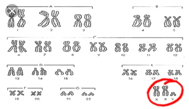 Alteracion cromosomica