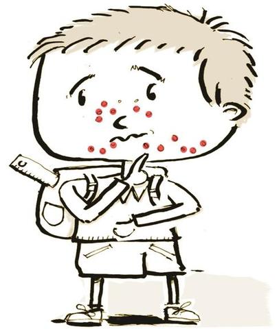 Rl médico francés Guillaume de Baillou