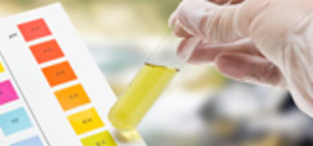 Cromatografía en papel