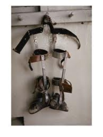 Biosocial: Braces Were Taken Off