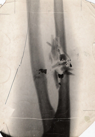 Marie Curie's Contribution to the War