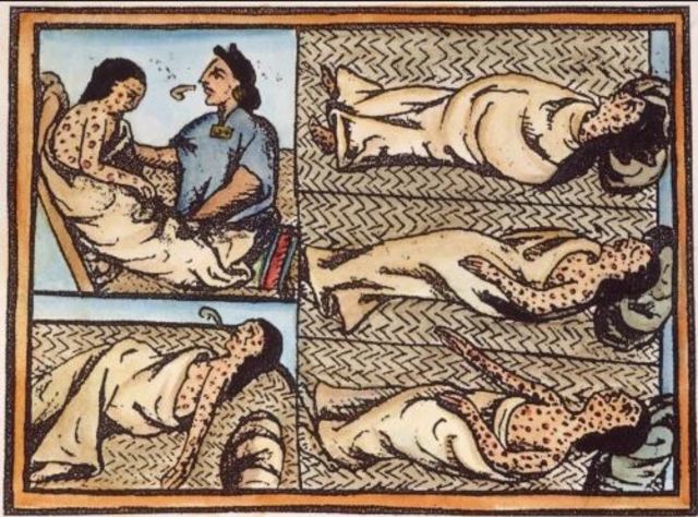 Epidemia de Viruela y otras EFEs