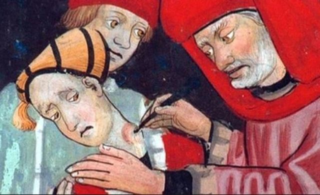 Fiebre amarilla y paludismo