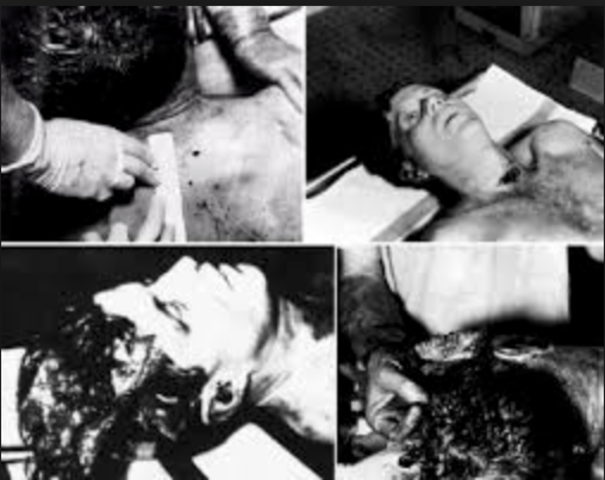 LAS FOTOGRAFÍAS Y RADIOGRAFÍAS DE LA AUTOPSIA HAN SIDO ENTREGADAS