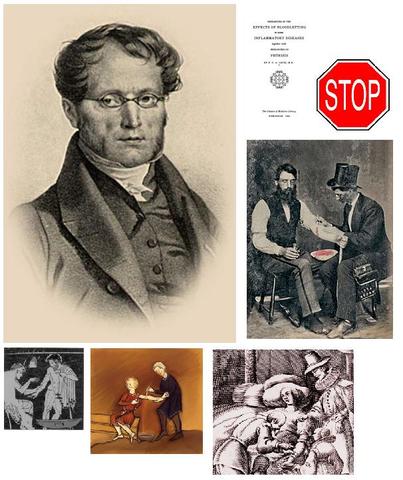 Dr. Pierre Charles Alexandre Louis challenges bloodletting treatments