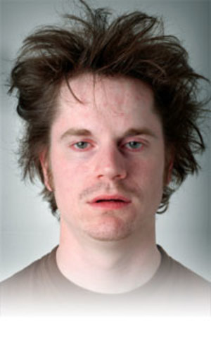 Consecuencias del abuso a corto plazo