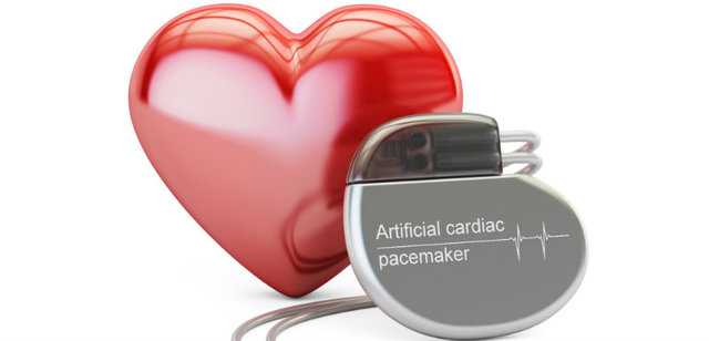 Pacemaker