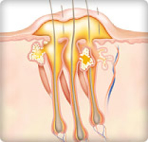 Death of thousands in Portugal