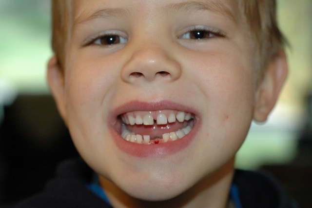 S'em cau la primera dent