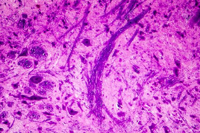 Primera fotomicrografia permanente