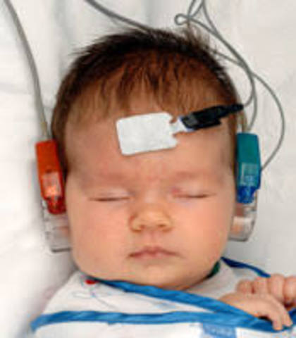 1993: Hearing screenings begin for all infants