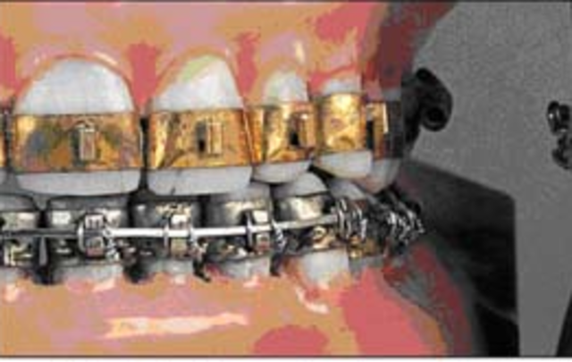 20th century of today times