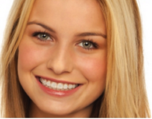 the dawn of the metal mouth