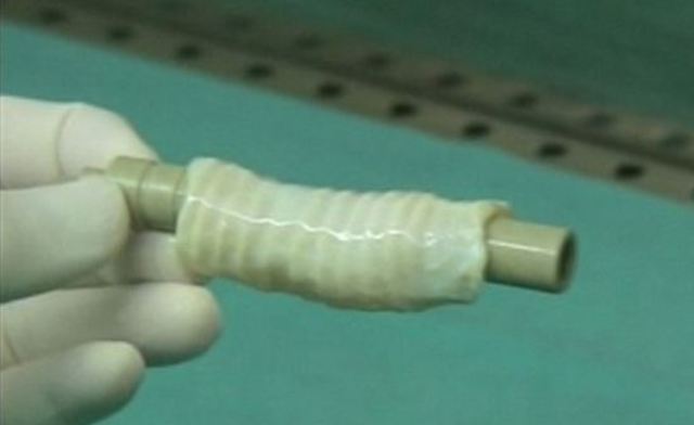 Primer trasplante de un órgano completo cultivado