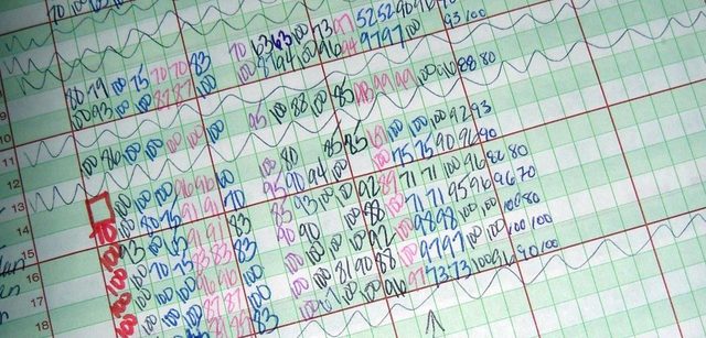 FRANCÊS - TRABALHO DE CAMPO