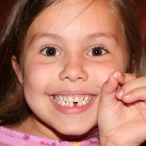 Child Loses First Tooth!