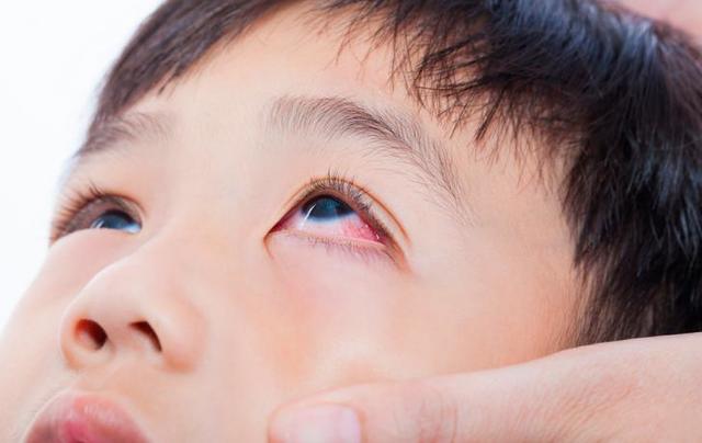 2017 México consigue eliminar el  Tracoma, como problema de salud pública.