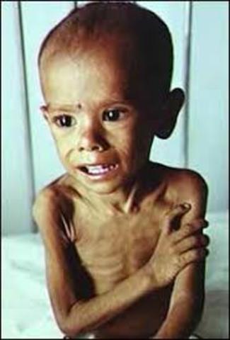 preocupación social de los problemas relacionados con la desnutrición