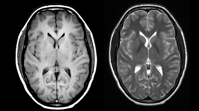 Paraclínicos de ingreso