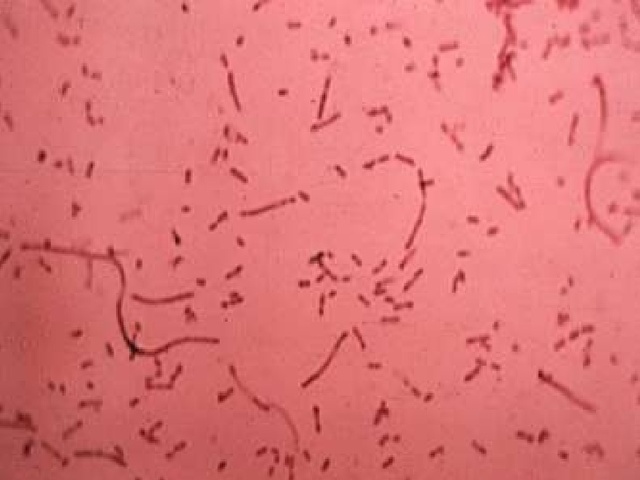 Aislamiento de la primera enzima de restricción Hind II