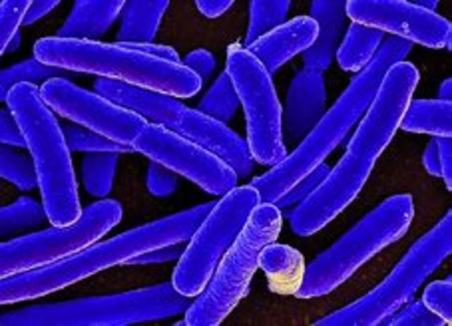 Se obtiene insulina a partir de una bacteria (E. Coli)