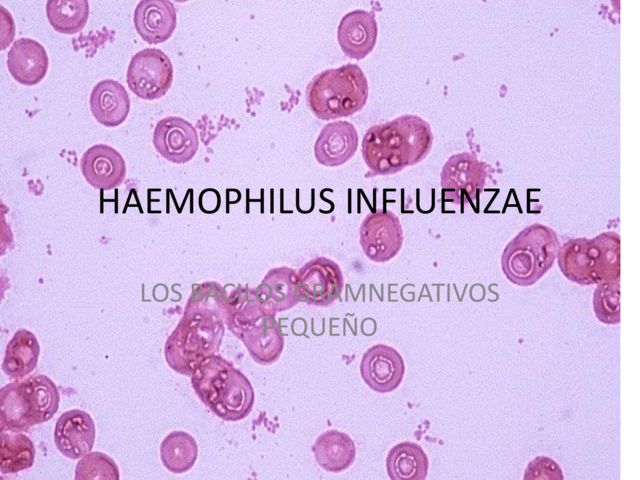 Haemophilus Influenzae