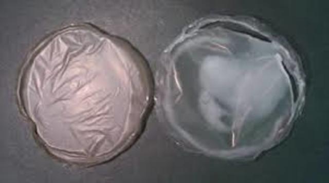 Polihidroxibutirato (PHB)