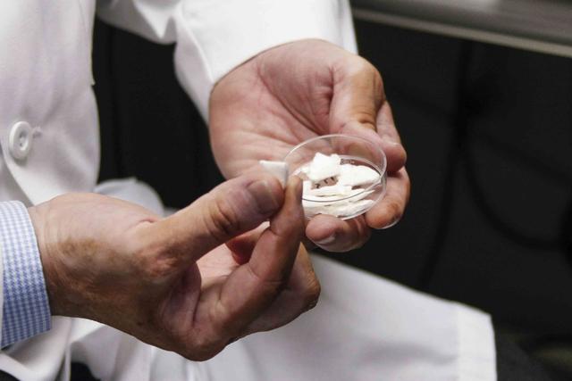 Regeneración de huesos de columna con cáscara de cangrejo