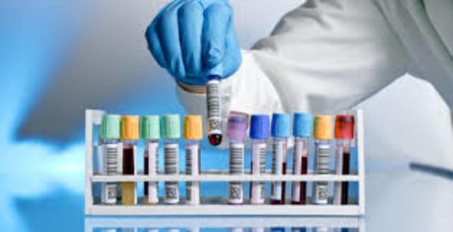 Pruebas de laboratorio