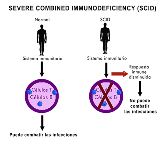 Primer Tratamiento de terapia génica con éxito en niños